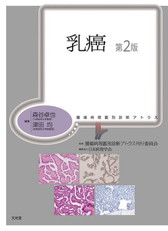 乳癌 株式会社文光堂