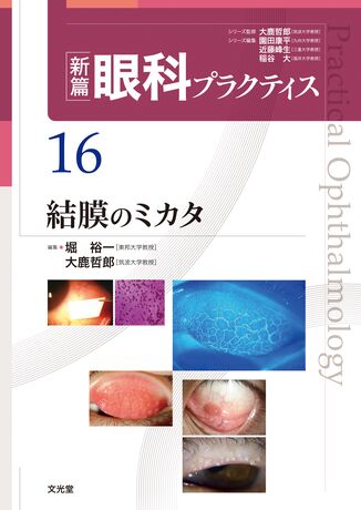 当店在庫してます! 結膜のミカタ | 株式会社文光堂 臨床医学