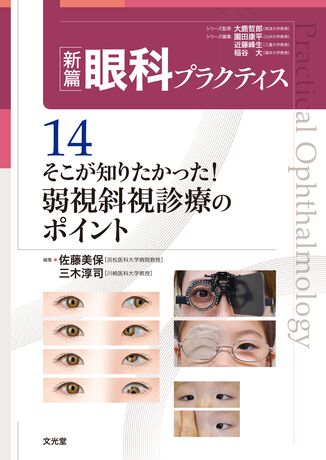 そこが知りたかった！弱視斜視診療のポイント | 株式会社文光堂