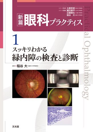 スッキリわかる緑内障の検査と診断 | 株式会社文光堂