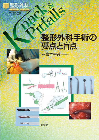 整形外科手術の要点と盲点 | 株式会社文光堂