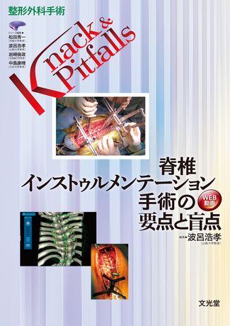 脊椎インストゥルメンテーション手術の要点と盲点 | 株式会社文光堂