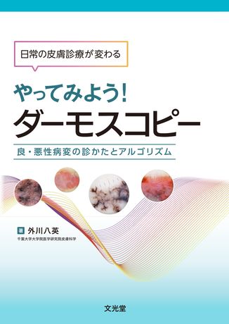 やってみよう！ダーモスコピー | 株式会社文光堂