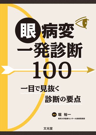 眼病変一発診断100 | 株式会社文光堂