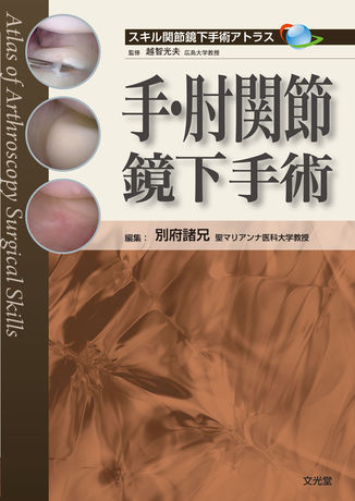 手・肘関節鏡下手術 | 株式会社文光堂