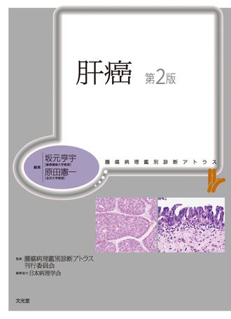 再入荷！】 腫瘍病理鑑別診断アトラス 子宮体癌 裁断済み 第2版 健康 