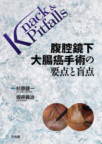 腹腔鏡下大腸癌手術の要点と盲点 | 株式会社文光堂