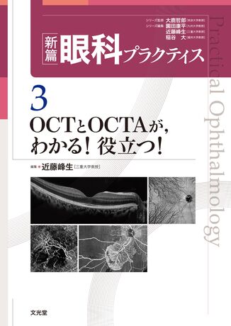 OCTとOCTAが，わかる！役立つ！ | 株式会社文光堂