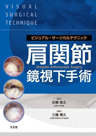 肩関節鏡視下手術 株式会社文光堂