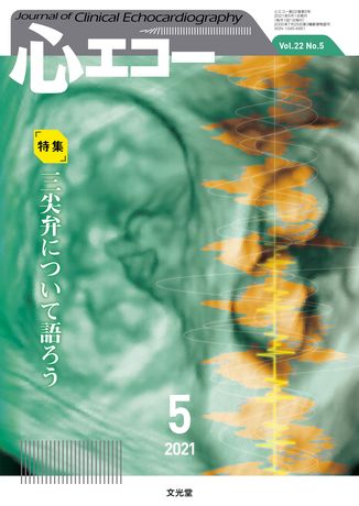 心エコー 2021年5月号（22巻5号）- 三尖弁について語ろう（電子版のみ） | 株式会社文光堂 - www.unidentalce.com.br