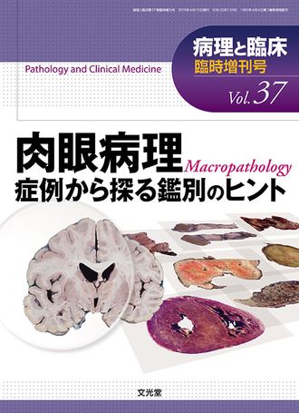 病理と臨床 2019年臨時増刊号（37巻）- 肉眼病理 | 株式会社文光堂