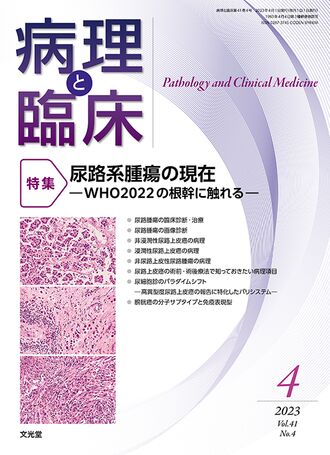 病理と臨床 2023年4月号（41巻4号）- 尿路系腫瘍の現在 | 株式