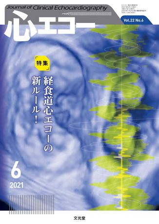 心エコー 2021年6月号（22巻6号）- 経食道心エコーの新ルール！（電子 