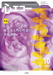 心エコー | 株式会社文光堂