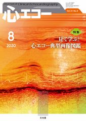 心エコー | 株式会社文光堂 心エコー | 株式会社文光堂
