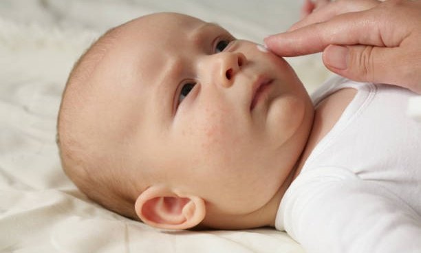 Costra láctea en bebés ¿Qué es y como eliminarla?