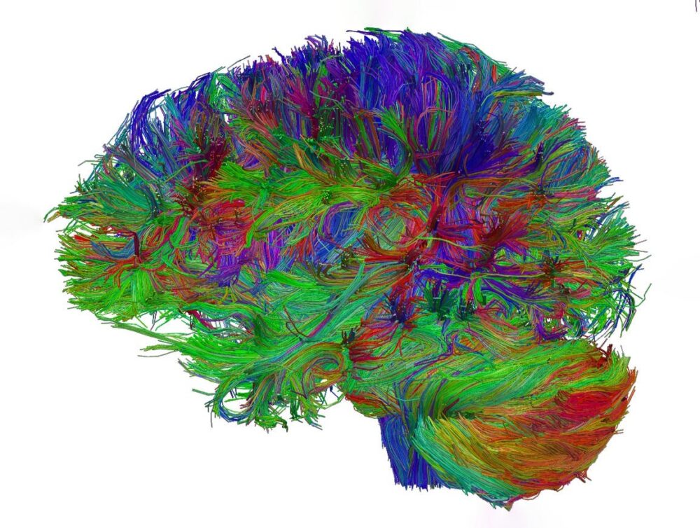 Dans le cerveau, ce sont les connexions qui commandes ©CNRS