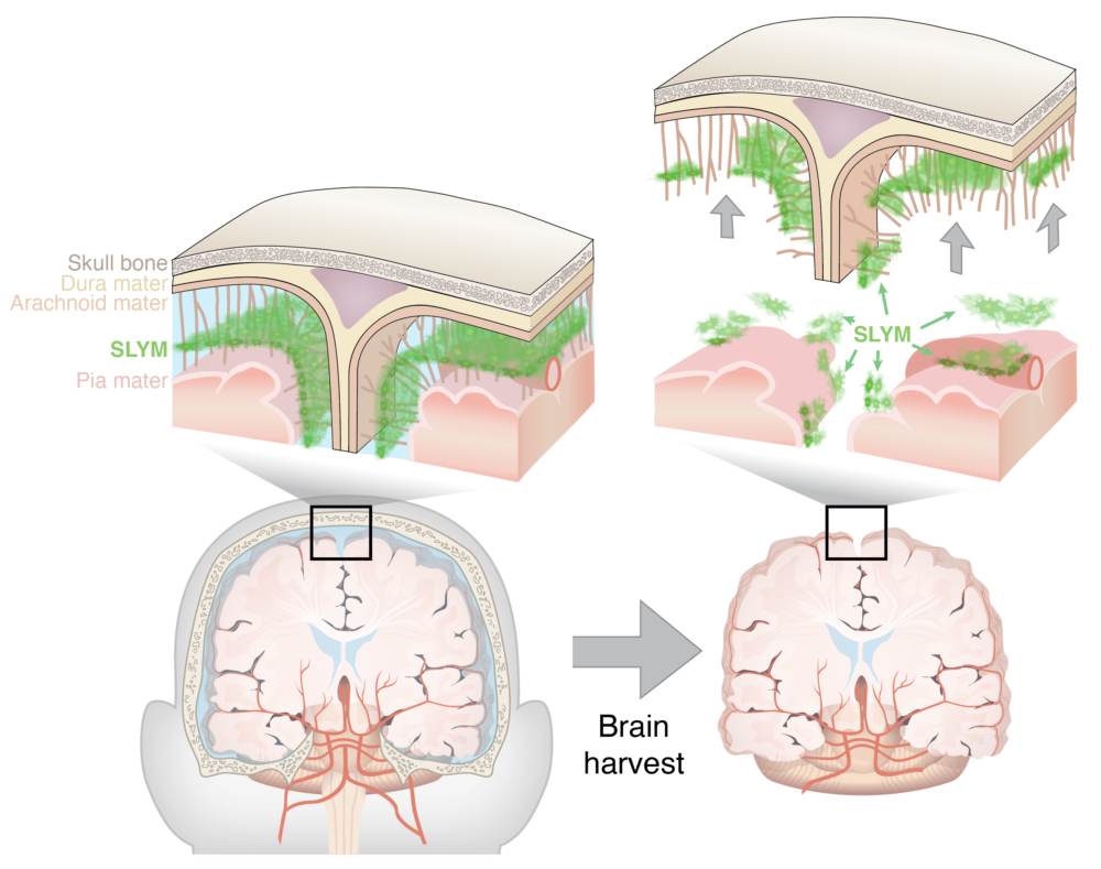 Découverte d’une quatrième méninge enveloppant le cerveau dénommée SLYM ©Université de Copenhague