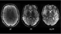 3 images en coupe d'un cerveau vu par IRM, selon 3 puissance de champ magéntique différent : 3, 7 et 11,7 teslas. Crédit : CEA