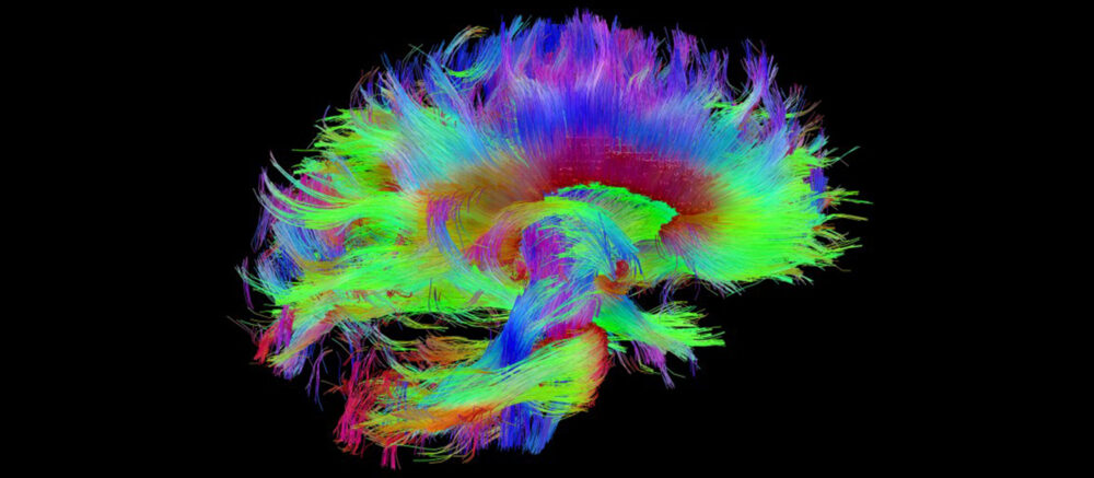 Faisceaux des fibres cérébrales (IRM)