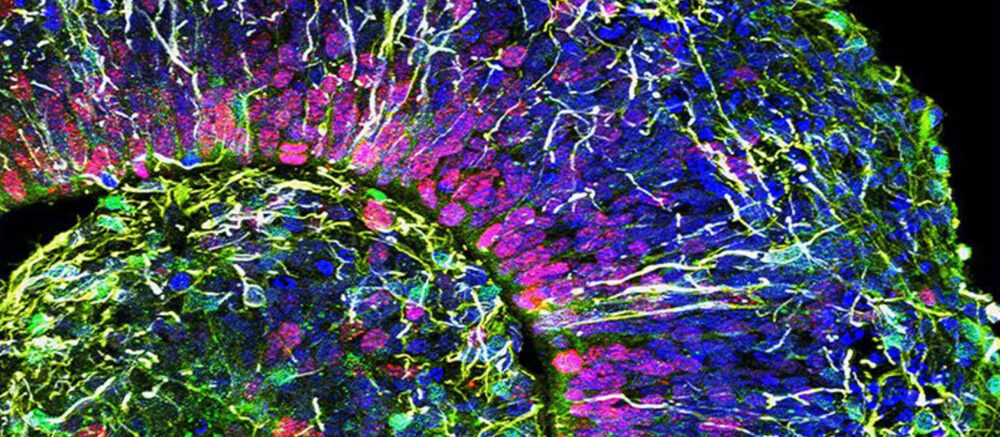 Coupe d'un organoïde de cerveau (©Muotri Lab/UCTV)