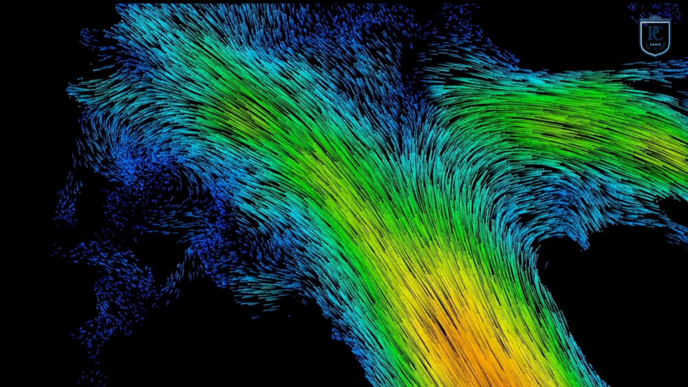 Vascularisation du cerveau humain (©ESPCI Paris - PSL, Inserm, CNRS)