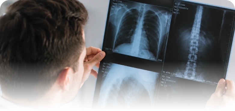 Orthopedics clinician reviewing spine and chest X-rays