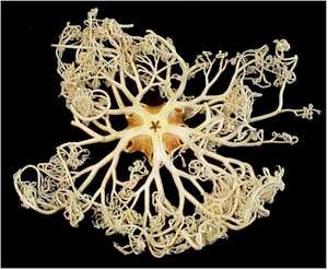 Basket Star