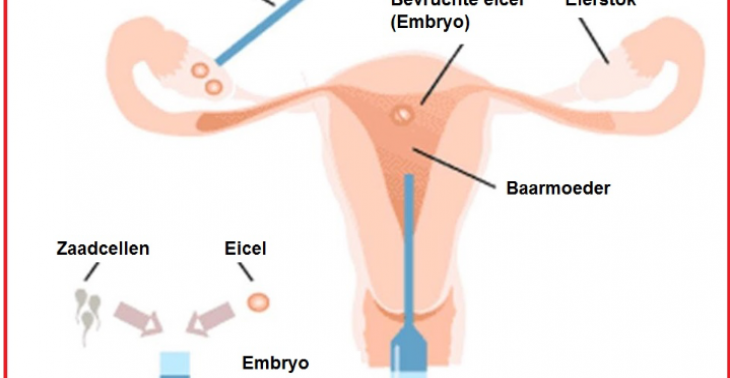 Dure ivf behandeling