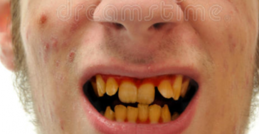 Happy Teeth