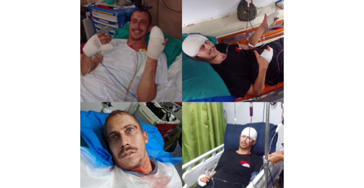 Gewapende overval met marteling. Armed robbery &amp; tortured.Please help Stijn