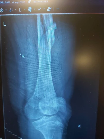 20201017 155151 optimized.