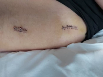 20201024 113752 optimized.