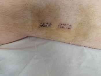 20201024 113756 optimized.