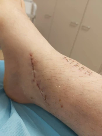 20201109 091645 optimized.