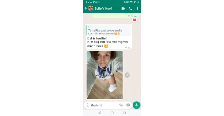 Steunactie voor prothese