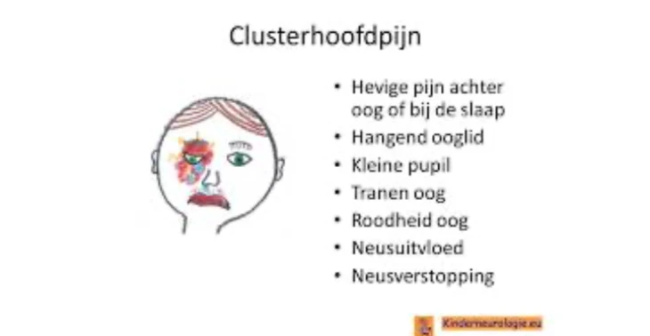 Clusterhoofdpijn