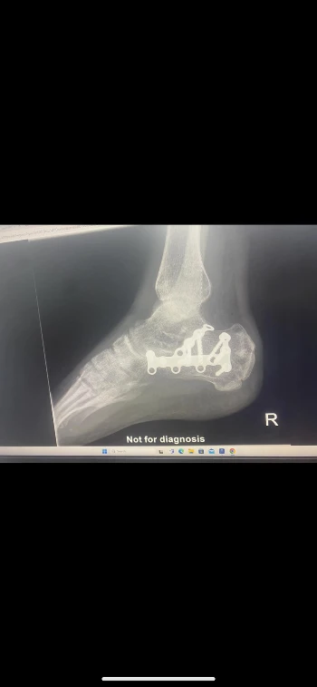 34846312 29eb 4a8d 9b98 eaa23c48751d.