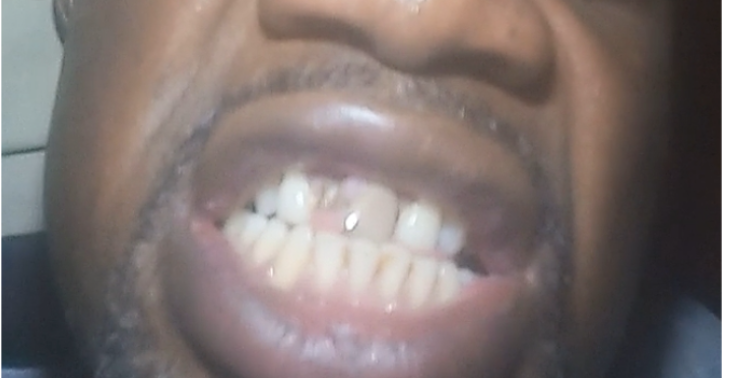 Seeking funds for dental surgery.