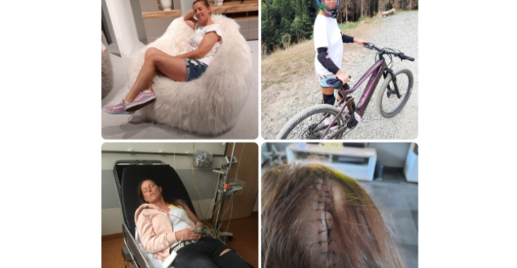 Krebs im Kopf - Cancer in my head