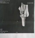 20240222 155652