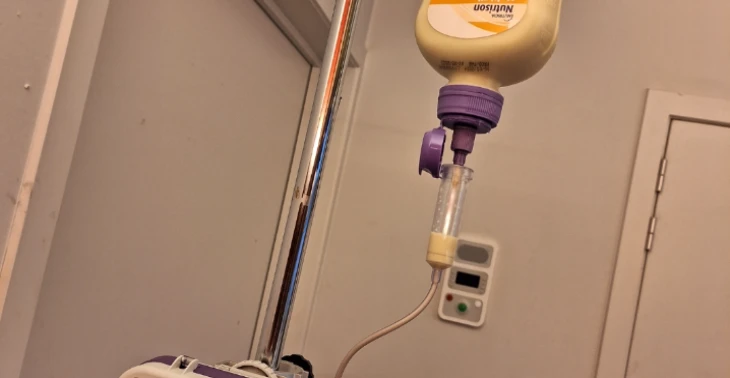 Verzamel sondevoeding voor kankerpatiënten