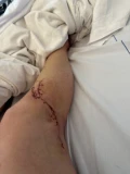 img 0848