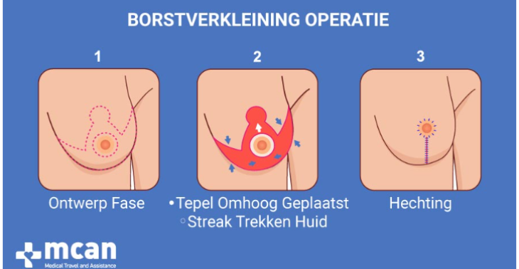 Medische hulp nodig