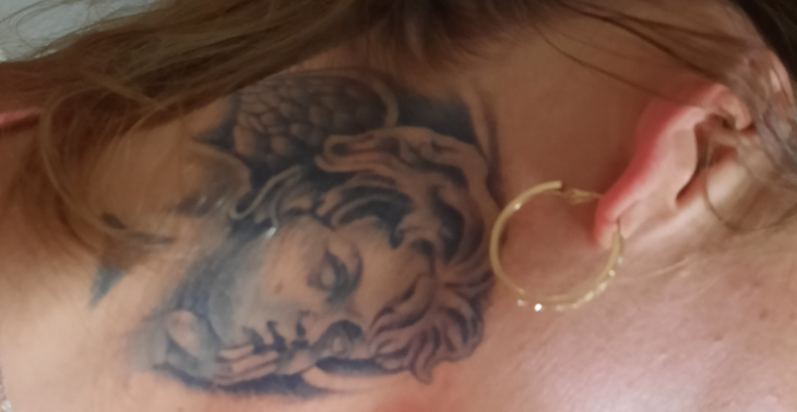 Tattoos weg laseren