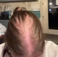 img 0132