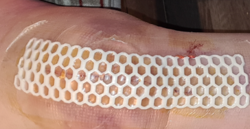 Help mijn mama een nieuwe knie te krijgen en huis aan te passen