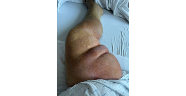 Hulp gevraagd voor onze gehandicapte buurman Marcel