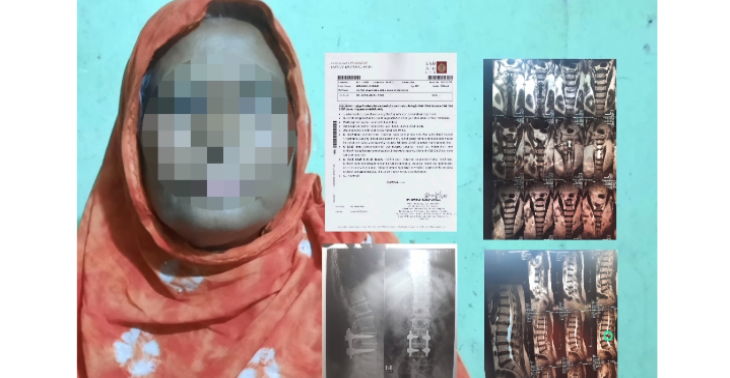 Advanced Treatment Needed for Mother Suffering from Spinal and Bone Degener