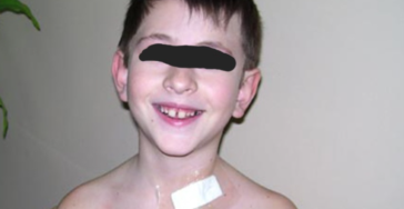Mein Krebskranker Sohn Elias (10)